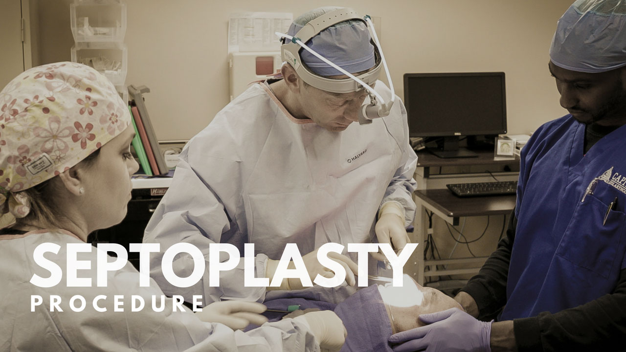 Septoplasty Procedure